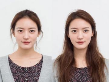煙臺女子花費6萬元種植12顆牙兩年后全拆體重驟降引發(fā)熱議