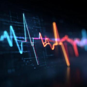 心臟早搏:理解其成因與管理策略