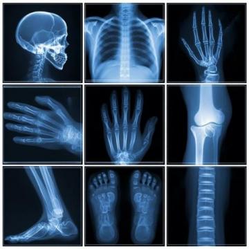 放射醫(yī)學(xué)技術(shù)考試口訣大全：高效記憶關(guān)鍵知識(shí)點(diǎn)