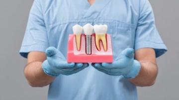 種植牙維護(hù)不用難(種植牙維護(hù)常識(shí))