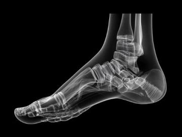 摔過一次，才知道鞋跟高度=住院天數