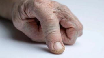 揭秘哺乳動物五指之謎:遺傳密碼與自然選擇的力量